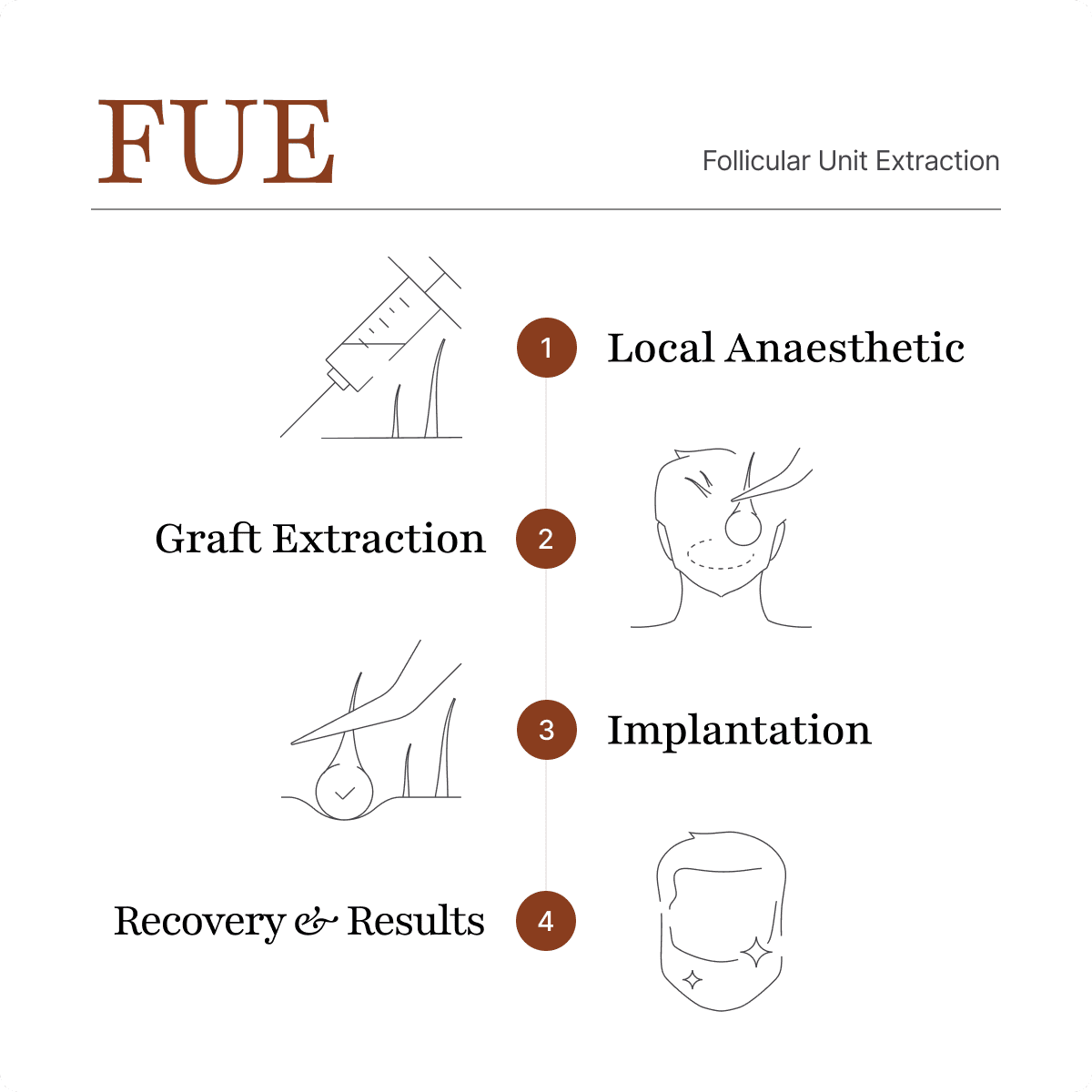 DHI technique being used for a beard transplant procedure.