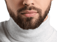 Beard Transplant