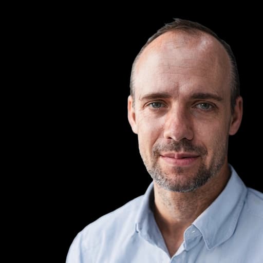 Before AI hairline simulation — male pattern thinning