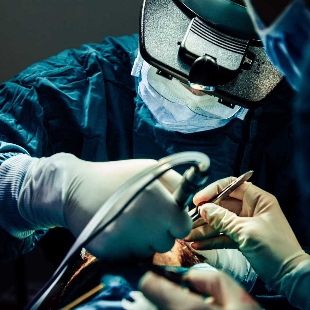 Surgeon carefully designing hairline aesthetics with precision and expertise