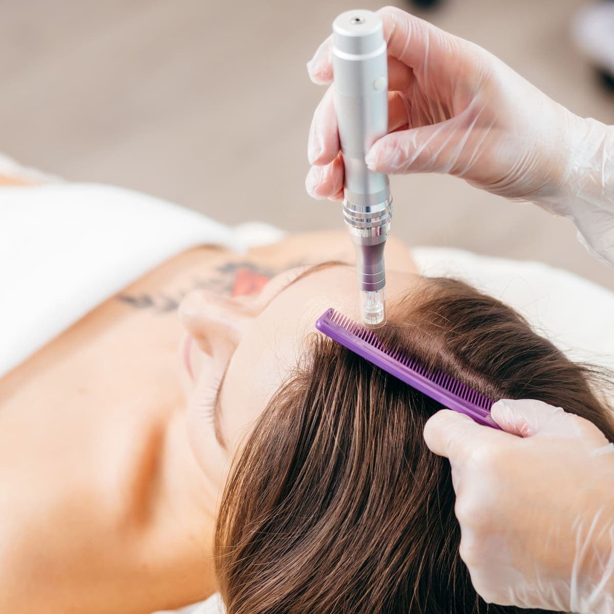 Female pattern hair loss illustration