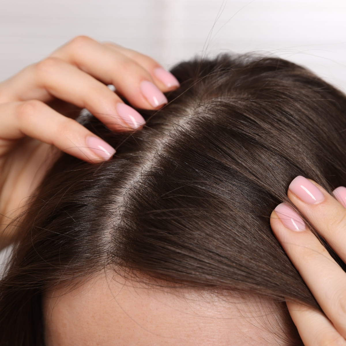Close-up of a natural-looking female hair transplant result